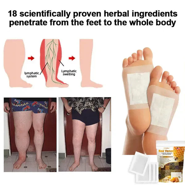 Bee Venom Lymphatic Daiamage & Sliming Patches (10 Patches)