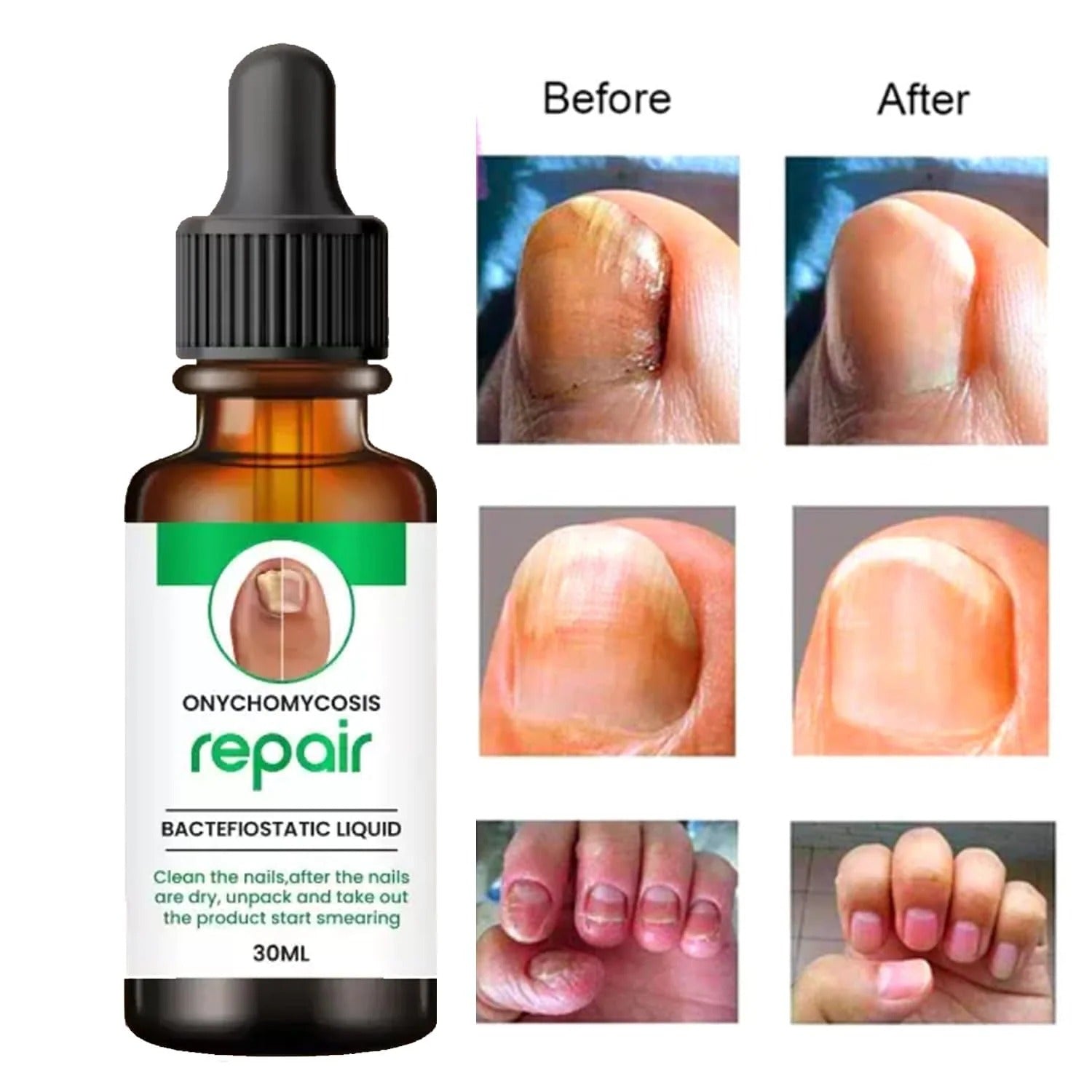 Natural Profesional Serum For Nail